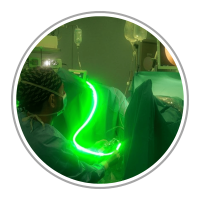 Cirugía Láser de Próstata - Green Laser de Prostata