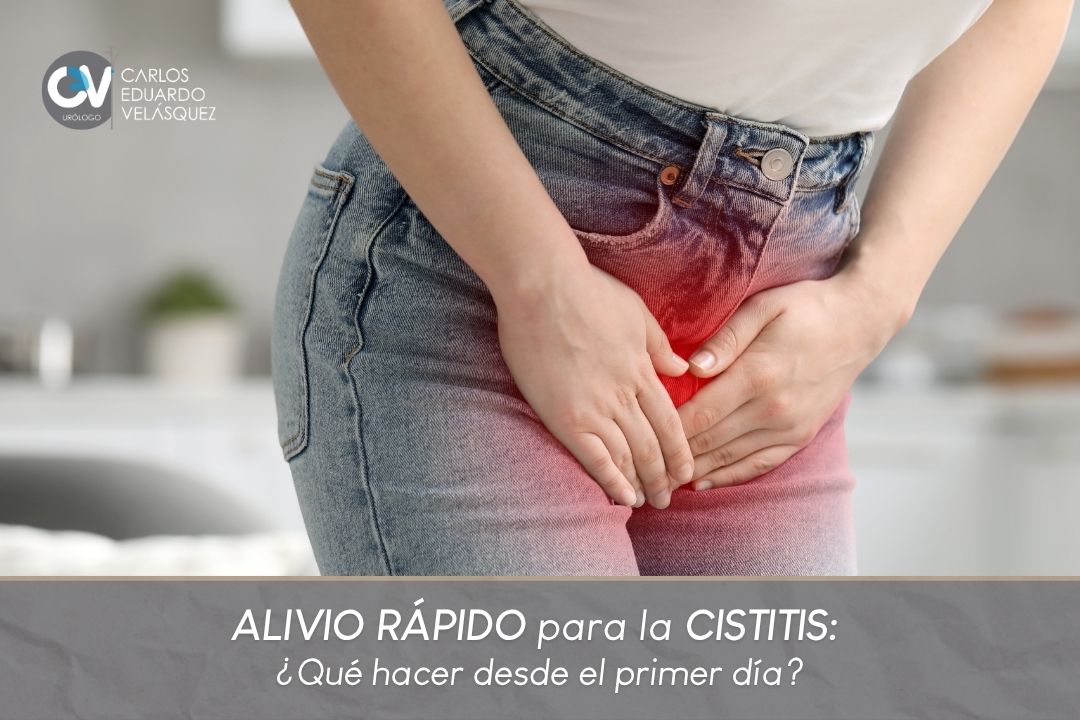 Cómo quitar la cistitis inmediatamente - Dr. Carlos Velásquez - Urólogo en Medellín