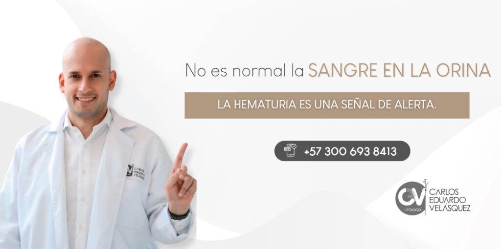 Sangre en la orina-Dr. Carlos Velásquez