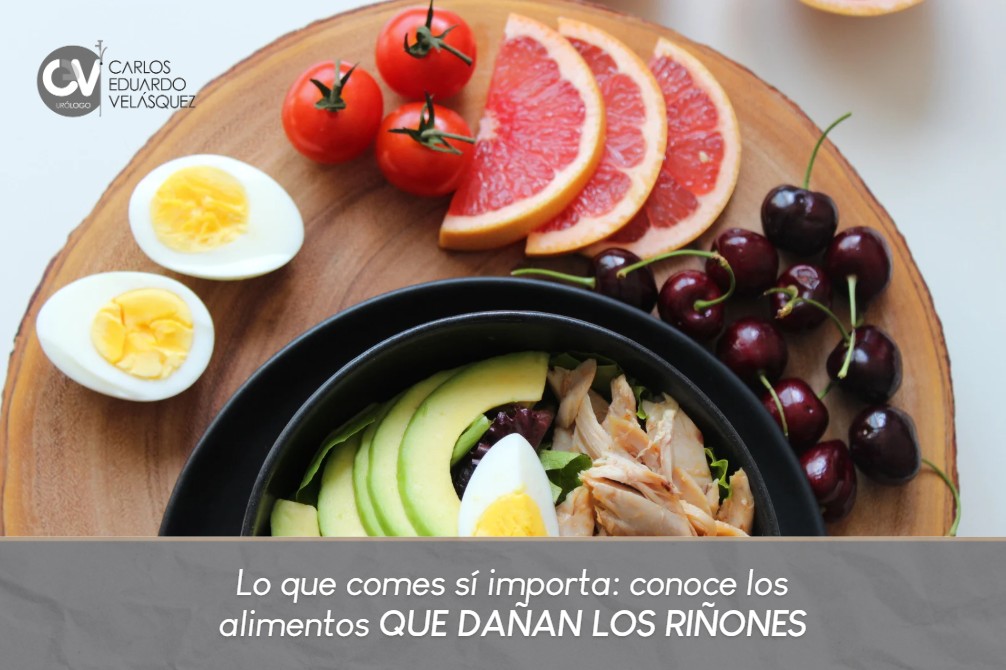 Alimentos que dañan los riñones-Dr. Carlos Velásquez