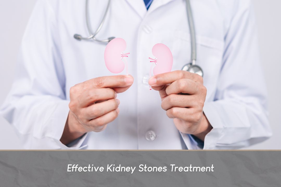 Kidney Stones Treatment by Urology Specialist in Medellín - Dr. Cárlos Velásquez