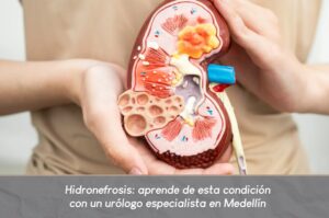 Hidronefrosis- Dr. Carlos Velasquez