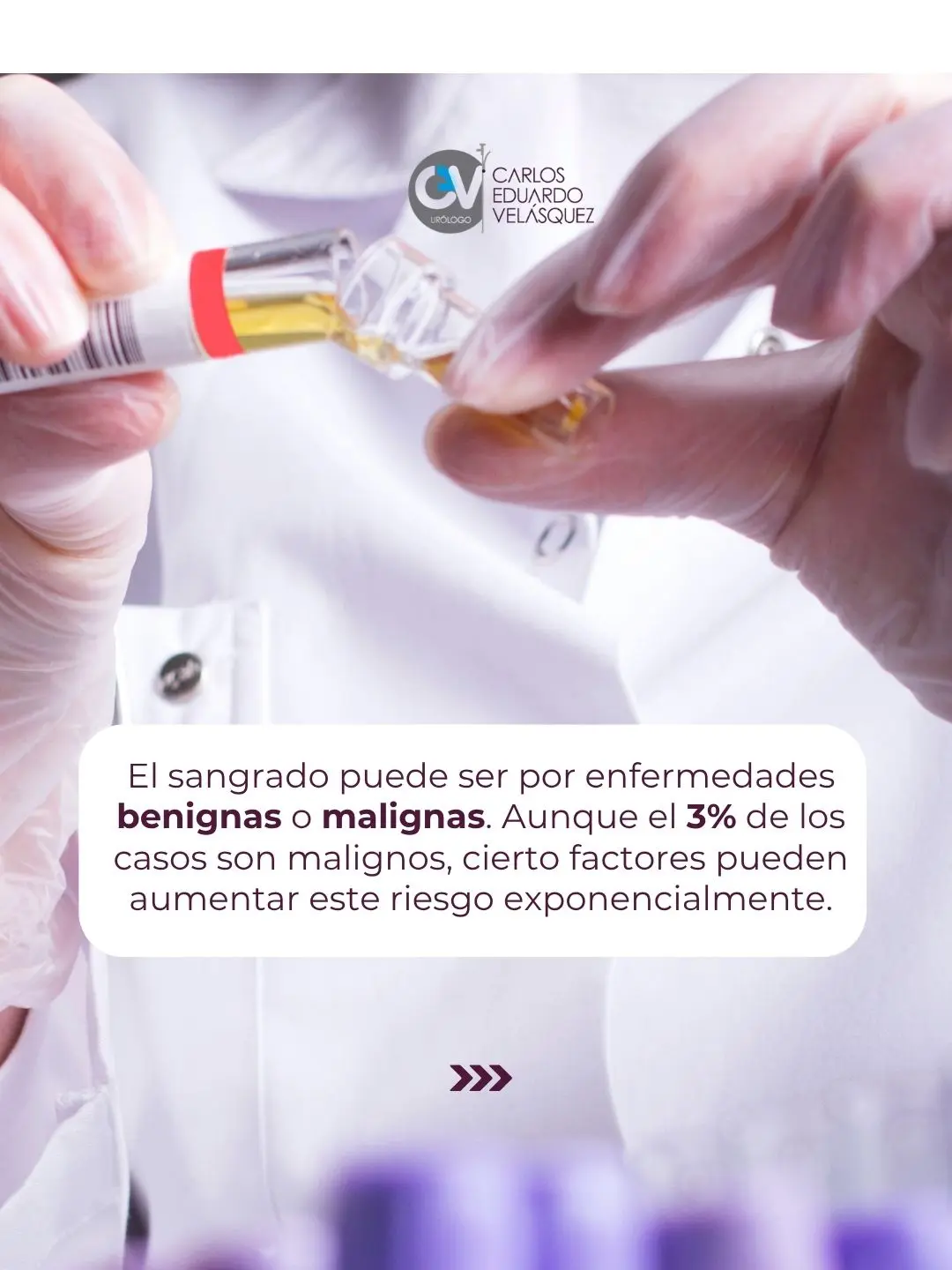 Sangre en la orina – Dr Carlos Velasquez 3