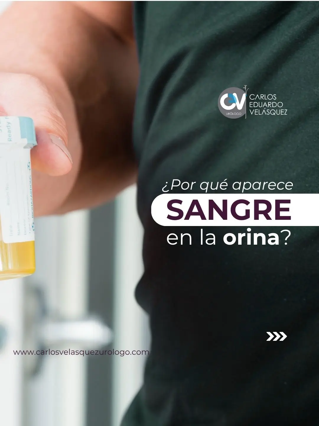 Sangre en la orina – Dr Carlos Velasquez