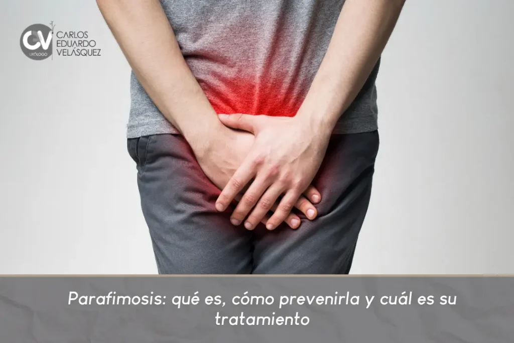 Parafimosis qué es, cómo prevenirla y cuál es su tratamiento - Dr. Carlos Velásquez - Medellín, Colombia