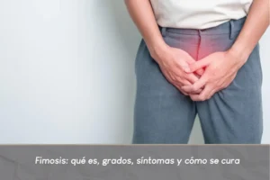 Fimosis- Dr. Carlos Velásquez- Urologo en Medellín